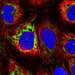 MAVS Polyclonal Antibody