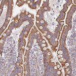 MAVS Antibody in Immunohistochemistry (Paraffin) (IHC (P))