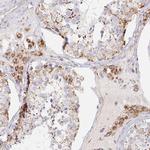 MAVS Antibody in Immunohistochemistry (Paraffin) (IHC (P))