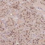 TPI1 Antibody in Immunohistochemistry (Paraffin) (IHC (P))