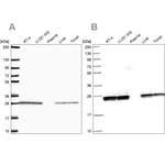 TPI1 Antibody in Western Blot (WB)