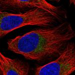 DDX28 Polyclonal Antibody