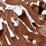 TPM1 Polyclonal Antibody