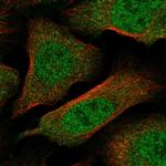 KPNA1 Polyclonal Antibody