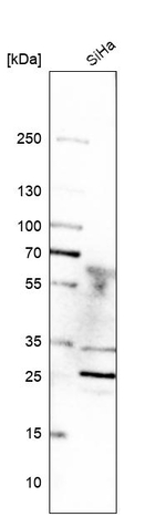 KPNA1 Antibody in Western Blot (WB)