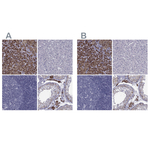 FDXR Antibody in Immunohistochemistry (Paraffin) (IHC (P))