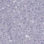 FDXR Antibody in Immunohistochemistry (Paraffin) (IHC (P))