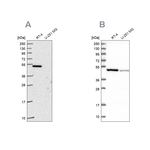 FDXR Antibody in Western Blot (WB)