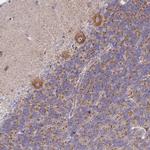 PKC eta Antibody in Immunohistochemistry (Paraffin) (IHC (P))