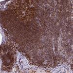 PKC eta Antibody in Immunohistochemistry (Paraffin) (IHC (P))