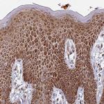 PKC eta Antibody in Immunohistochemistry (Paraffin) (IHC (P))