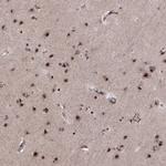 ZCCHC17 Antibody in Immunohistochemistry (Paraffin) (IHC (P))