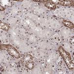 ZCCHC17 Antibody in Immunohistochemistry (Paraffin) (IHC (P))