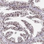 ZCCHC17 Antibody in Immunohistochemistry (Paraffin) (IHC (P))