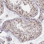 ZCCHC17 Antibody in Immunohistochemistry (Paraffin) (IHC (P))