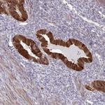 CMPK1 Antibody in Immunohistochemistry (Paraffin) (IHC (P))
