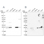 CMPK1 Antibody in Western Blot (WB)