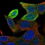 GSTA1 Polyclonal Antibody