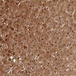 GSTA1 Antibody in Immunohistochemistry (Paraffin) (IHC (P))