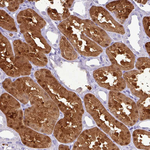 GSTA1 Antibody in Immunohistochemistry (Paraffin) (IHC (P))