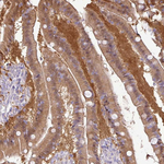 GSTA1 Antibody in Immunohistochemistry (Paraffin) (IHC (P))