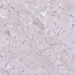 GSTA1 Antibody in Immunohistochemistry (Paraffin) (IHC (P))