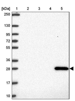 GSTA1 Antibody in Western Blot (WB)