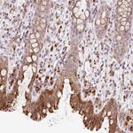 CEBPZOS Polyclonal Antibody