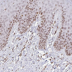 HOXC10 Antibody in Immunohistochemistry (Paraffin) (IHC (P))