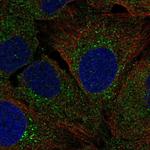 AGR3 Polyclonal Antibody