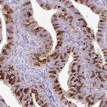 AGR3 Antibody in Immunohistochemistry (Paraffin) (IHC (P))