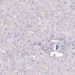 AGR3 Antibody in Immunohistochemistry (Paraffin) (IHC (P))