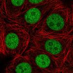 ZRANB2 Antibody in Immunocytochemistry (ICC/IF)