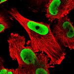 NONO Polyclonal Antibody