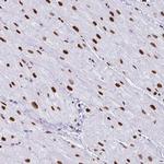 NONO Antibody in Immunohistochemistry (Paraffin) (IHC (P))