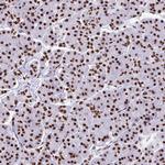 NONO Antibody in Immunohistochemistry (Paraffin) (IHC (P))