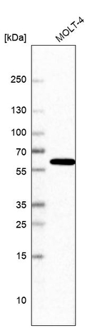 NONO Antibody in Western Blot (WB)