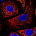 IDH3B Polyclonal Antibody