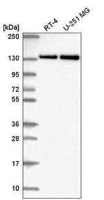 RNF40 Antibody in Western Blot (WB)