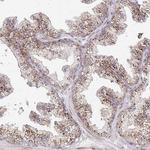 IDUA Polyclonal Antibody