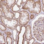 MRPL24 Polyclonal Antibody