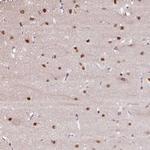TAF1A Antibody in Immunohistochemistry (Paraffin) (IHC (P))