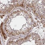 SMYD3 Antibody in Immunohistochemistry (Paraffin) (IHC (P))