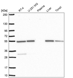 SMYD3 Antibody in Western Blot (WB)