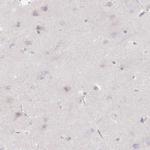 CRISP3 Antibody in Immunohistochemistry (Paraffin) (IHC (P))
