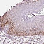 DUT Antibody in Immunohistochemistry (Paraffin) (IHC (P))