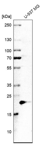 DUT Antibody in Western Blot (WB)