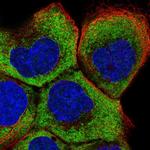 RPL5 Polyclonal Antibody