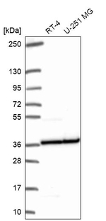 RPL5 Antibody in Western Blot (WB)