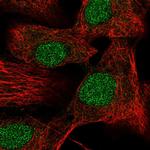 DR4 Polyclonal Antibody